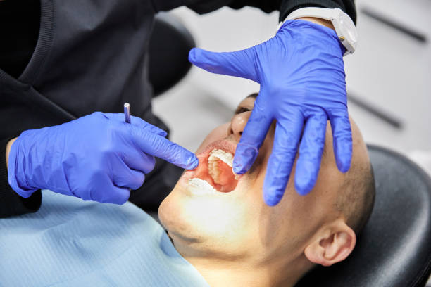 Best Emergency Dentist for Lost Fillings or Crowns in Troy, NY